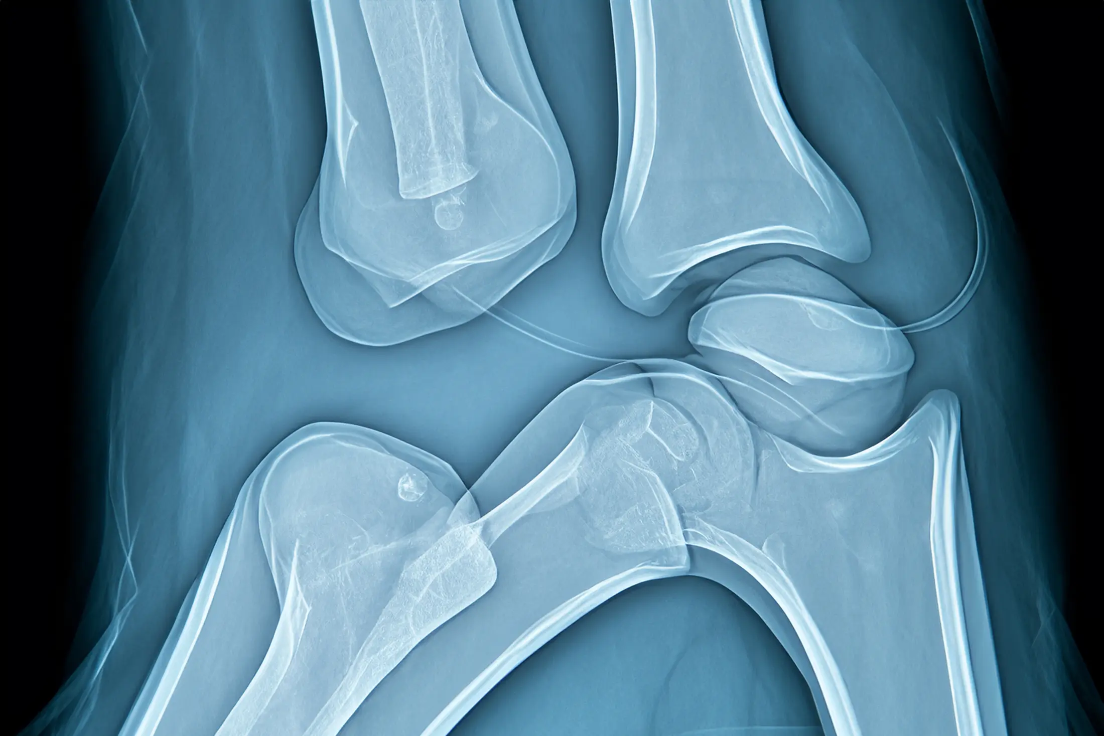 Texas Shred X-Ray Recycling